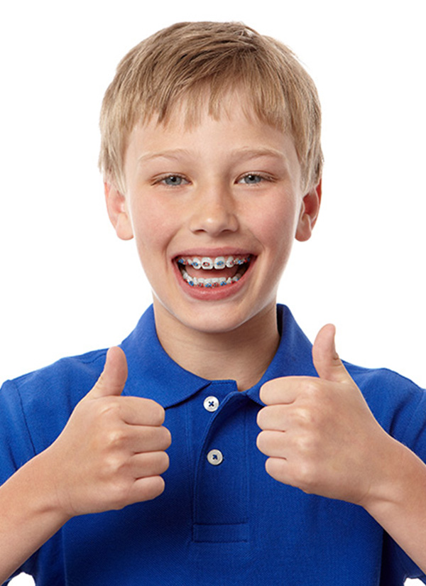 braces-children-1