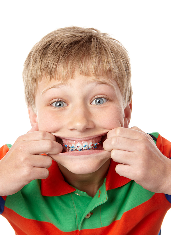 braces-children-2